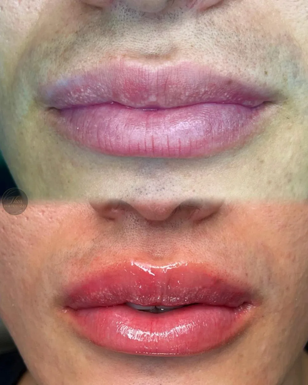 Antes e depois de Hidra Colors labial, cor renovada com brilho e naturalidade